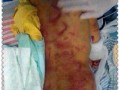 最新爆料母亲虐童案,揭开家庭暴力背后的黑暗面
